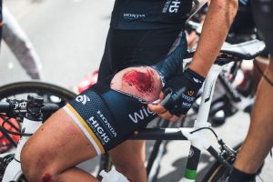 Cycling Injuries: Understanding Risks, Prevention, and Recovery